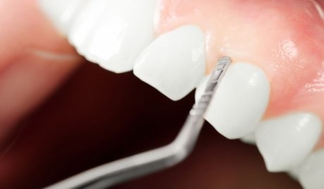 Europäischer Parodontologietag: Patienten erfahren durch Mundhygieneinstruktionen in der Zahnarztpraxis, wie sie Zähne und Zahnfleisch dauerhaft sauber halten können.